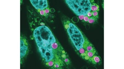 【GREAT NEWS】Development of Technology to Incorporate Photosynthetically Active Chloroplasts into Animal Cells